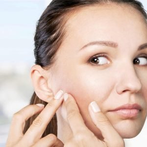 Acne Blend